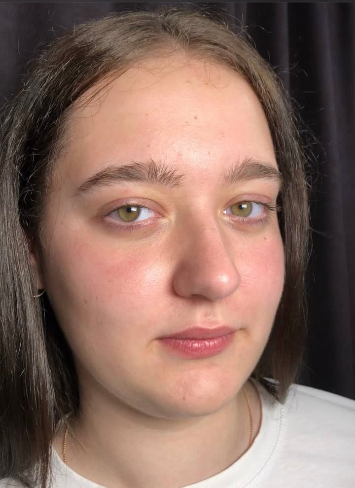 Sourcils clairs et clairsemés avant un brow lift et une coloration au henné